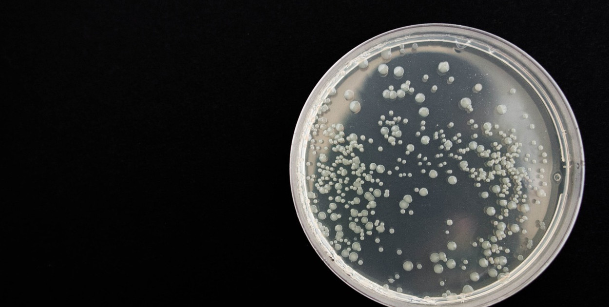 Zdjęcie ilustracyjne. Fot.: pixabay.com/pl